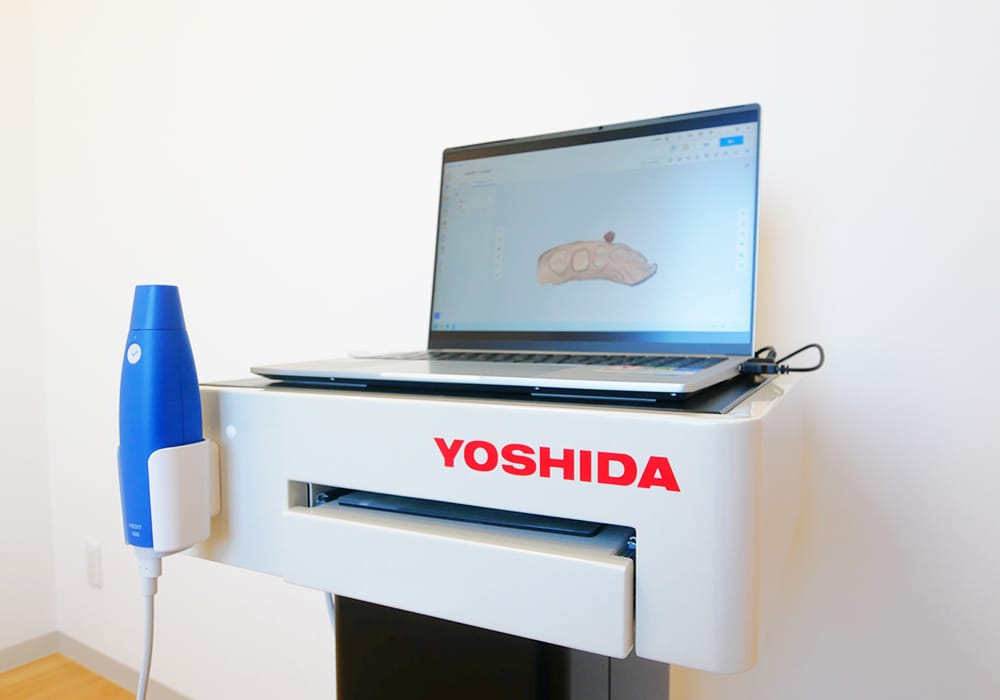 3D光学スキャナー